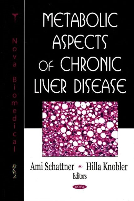 Book cover of: Metabolic Aspects of Chronic Liver Disease