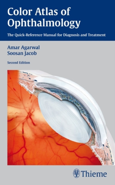 Book cover of: Color Atlas of Ophthalmology