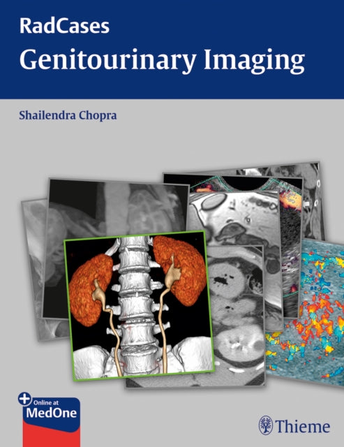 Book cover of: Radcases Genitourinary Imaging. By: Shailendra Chopra