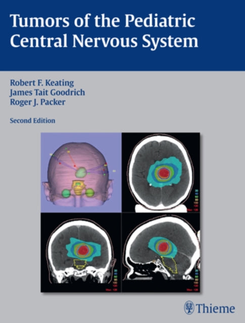 Book cover of: Tumors of the Pediatric Central Nervous System