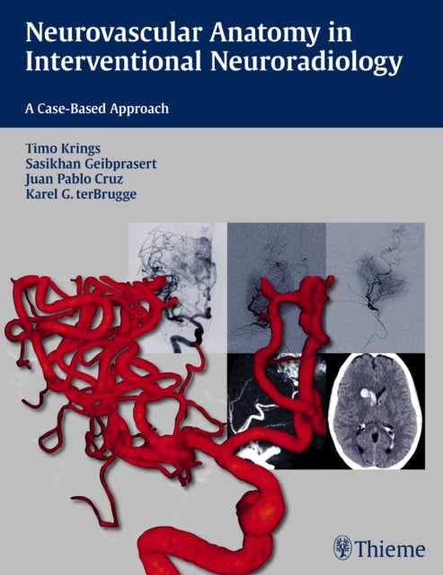 Book cover of: Neurovascular Anatomy in Interventional Neuroradiology. By: Timo Krings