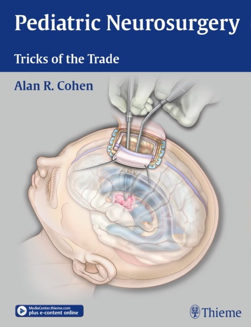 Book cover of: Pediatric Neurosurgery: Tricks of the Trade. By: Alan R. Cohen