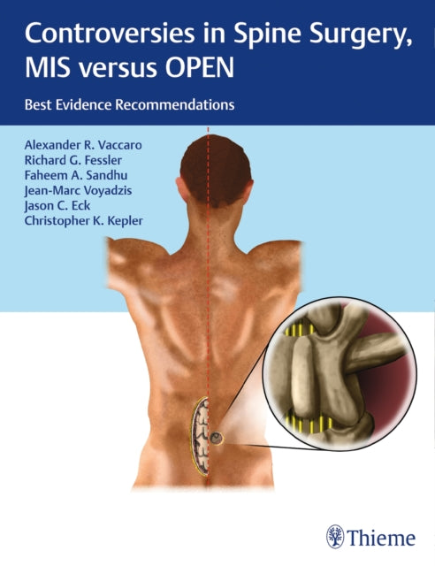 Book cover of: Controversies in Spine Surgery, MIS Versus OPEN. By: Alexander R. Vaccaro