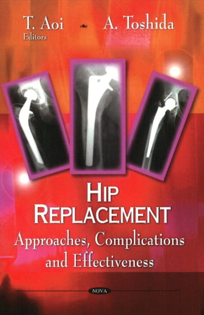 Book cover of: Hip Replacement