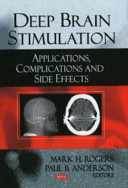Book cover of: Deep Brain Stimulation