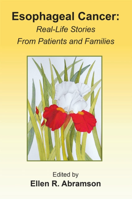 Book cover of: Esophageal Cancer