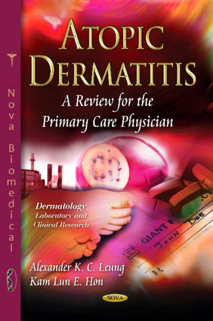 Book cover of: Atopic Dermatitis. By: Alexander K. C. Leung