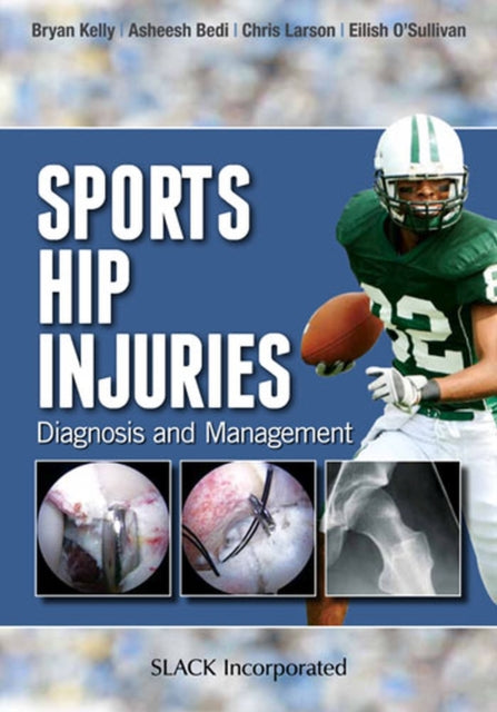 Book cover of: Sports Hip Injuries. By: Bryan Kelly