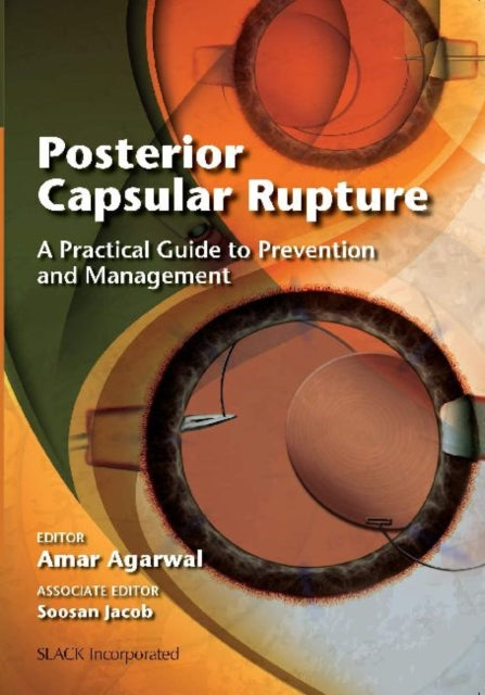 Book cover of: Posterior Capsular Rupture