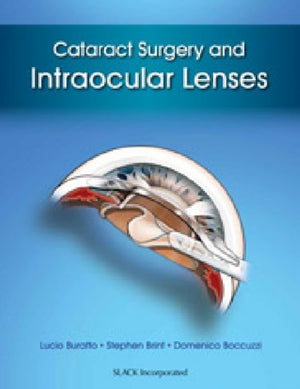 Cataract Surgery and Intraocular Lenses