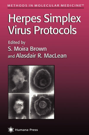Herpes Simplex Virus Protocols