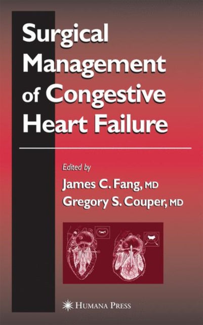 Book cover of: Surgical Management of Congestive Heart Failure. By: James C. Fang