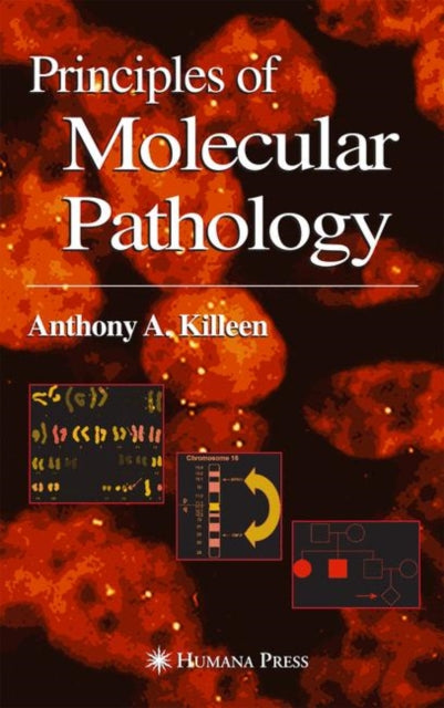 Book cover of: Principles of Molecular Pathology. By: Anthony A. Killen