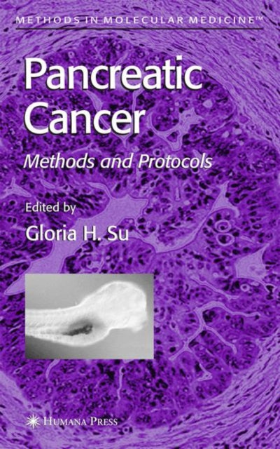 Book cover of: Pancreatic Cancer. By: Gloria H. Su