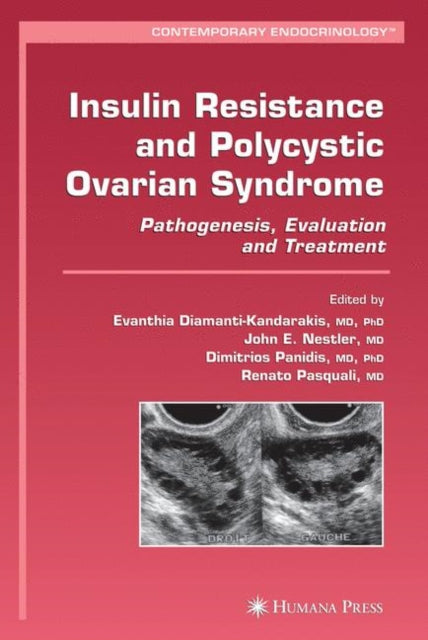 Book cover of: Insulin Resistance and Polycystic Ovarian Syndrome. By: Evanthia Diamanti-Kandarakis