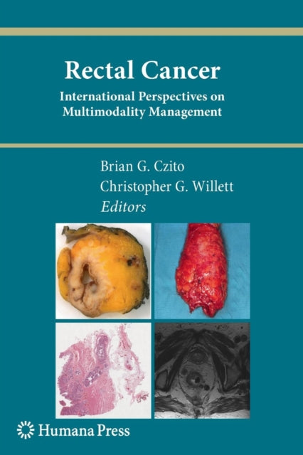 Book cover of: Rectal Cancer. By: Brian G. Czito