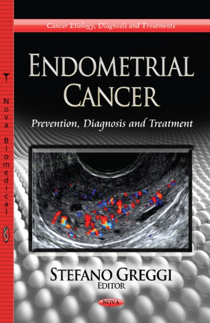 Book cover of: Endometrial Cancer