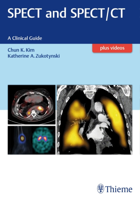 Book cover of: SPECT and SPECT/CT. By: Chun K. Kim