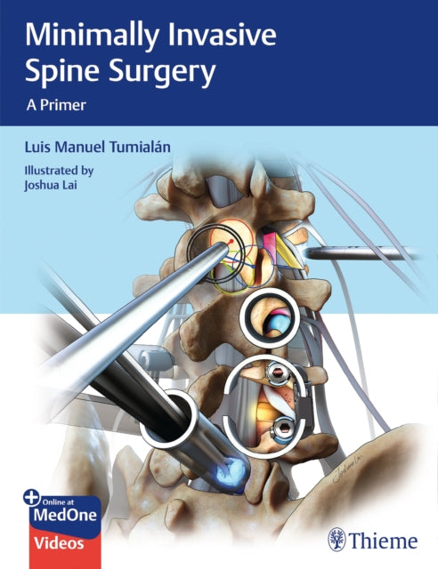 Book cover of: Minimally Invasive Spine Surgery. By: Luis Manuel Tumialan