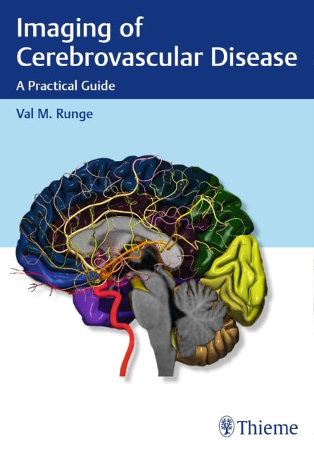 Book cover of: Imaging of Cerebrovascular Disease. By: Val M. Runge