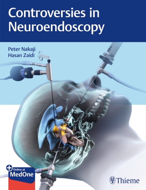 Book cover of: Controversies in Neuroendoscopy. By: Peter Nakaji