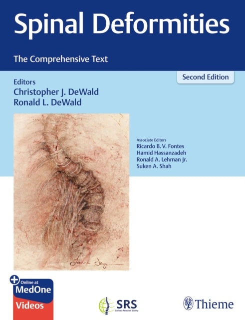 Book cover of: Spinal Deformities. By: Ronald L. DeWald