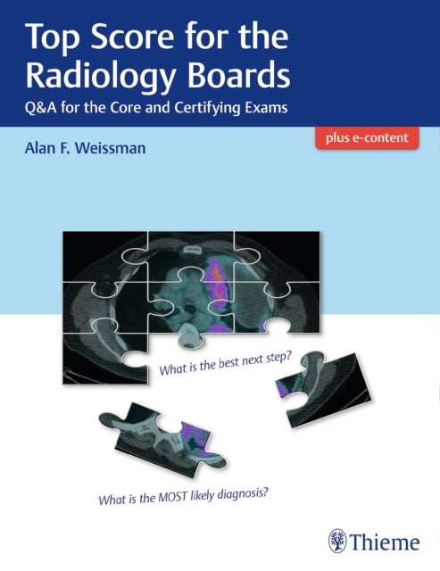 Book cover of: Top Score for the Radiology Boards. By: Alan Weissman