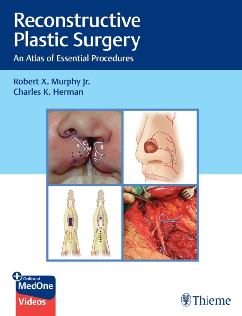 Book cover of: Reconstructive Plastic Surgery. By: Robert Murphy