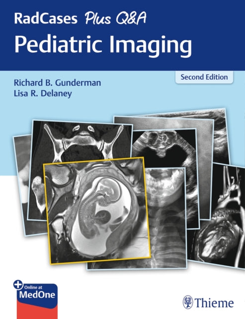 Book cover of: RadCases Plus Q&a Pediatric Imaging. By: Richard B. Gunderman