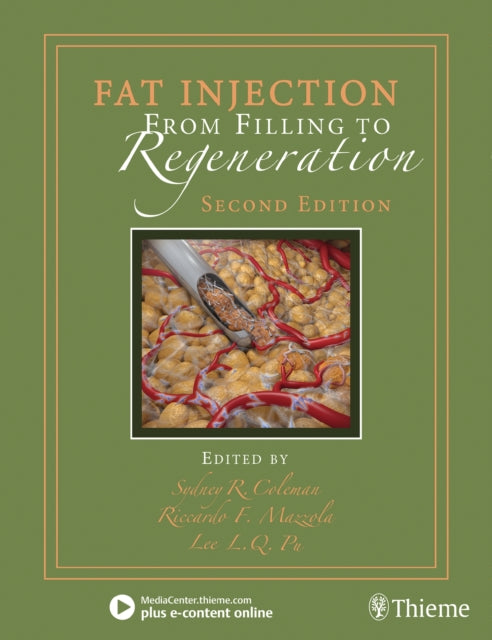 Book cover of: Fat Injection. By: Sydney R. Coleman