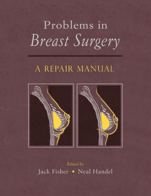 Book cover of: Problems in Breast Surgery. By: Jack Fisher