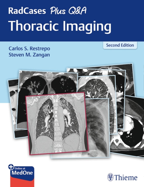 Book cover of: RadCases Plus Q&a Thoracic Imaging. By: Carlos S. Restrepo