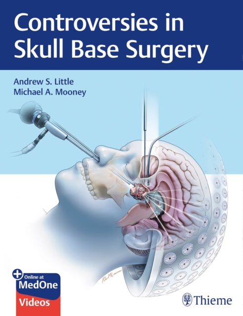 Book cover of: Controversies in Skull Base Surgery. By: Andrew S. Little