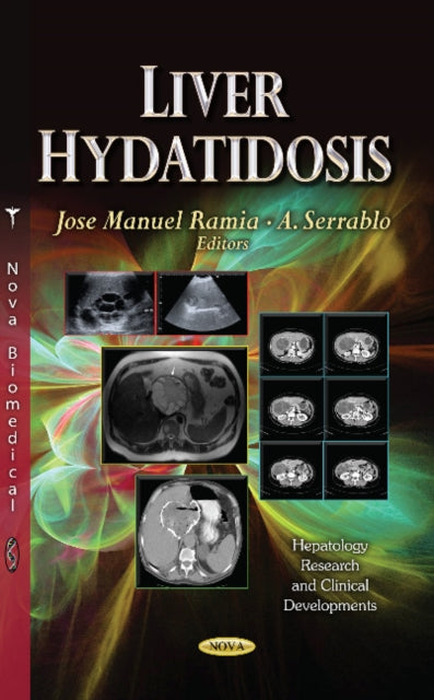 Book cover of: Liver Hydatidosis. By: Jose Manuel Ramia