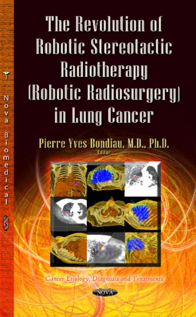 Book cover of: Revolution of Robotic Stereotactic Radiotherapy (Robotic Radiosurgery) in Lung Cancer. By: Pierre-Yves Bondiau