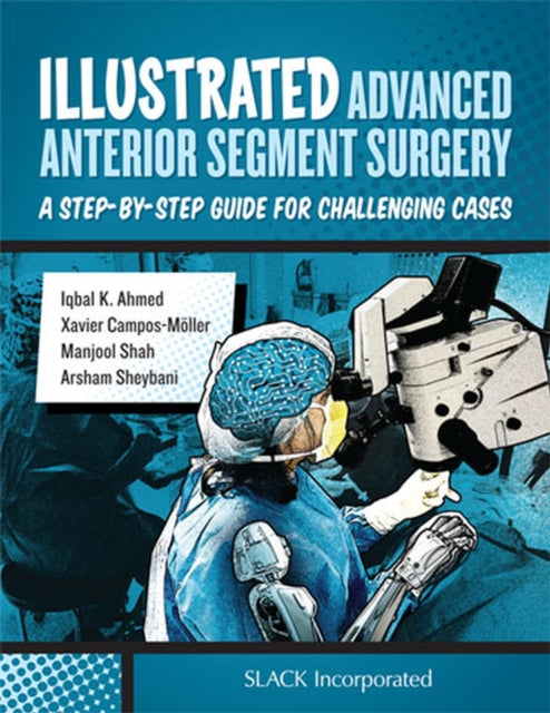 Book cover of: Illustrated Advanced Anterior Segment Surgery. By: Iqbal K. Ahmed