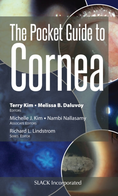 Book cover of: Pocket Guide to Cornea. By: Terry Kim