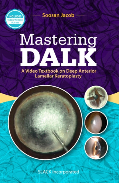 Book cover of: Mastering DALK. By: Soosan Jacob