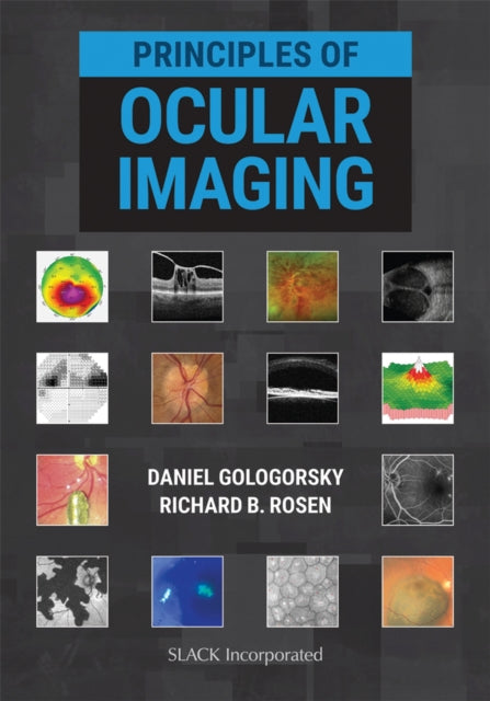 Book cover of: Principles of Ocular Imaging. By: Daniel Gologorsky