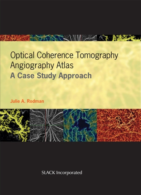 Book cover of: Optical Coherence Tomography Angiography Atlas. By: Julie A. Rodman