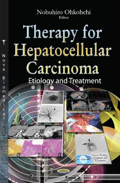 Book cover of: Therapy for Hepatocellular Carcinoma. By: Nobuhiro Ohkohchi