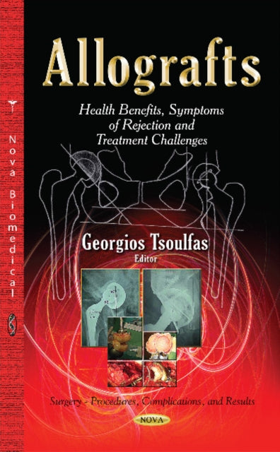 Book cover of: Allografts. By: Georgios Tsoulfas
