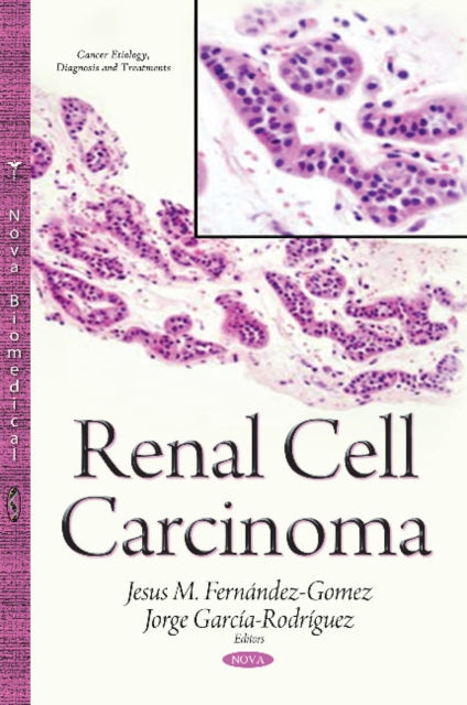 Book cover of: Renal Cell Carcinoma. By: Jesus M. Fernandez-Gomez