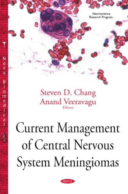 Book cover of: Current Management of Central Nervous System Meningiomas. By: Steven D. Chang