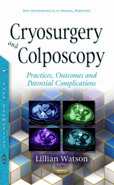 Book cover of: Cryosurgery & Colposcopy. By: Lillian Watson
