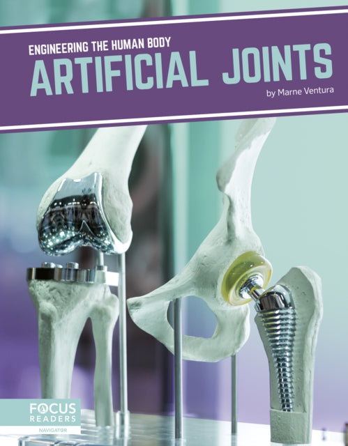 Book cover of: Artificial Joints