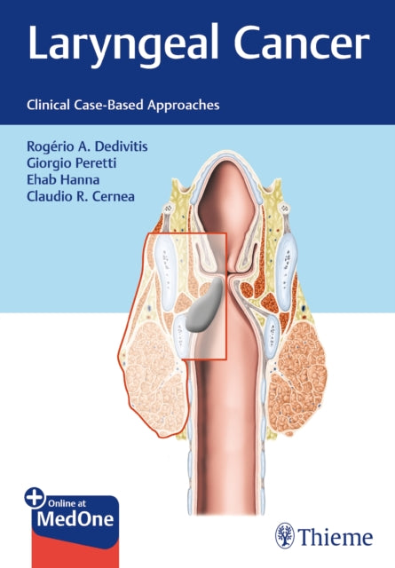 Book cover of: Laryngeal Cancer. By: Rogerio Dedivitis