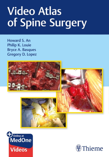 Book cover of: Video Atlas of Spine Surgery. By: Howard An