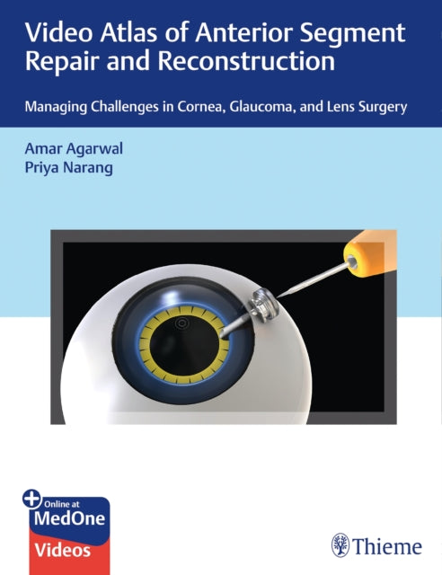 Book cover of: Video Atlas of Anterior Segment Repair and Reconstruction. By: Amar Agarwal