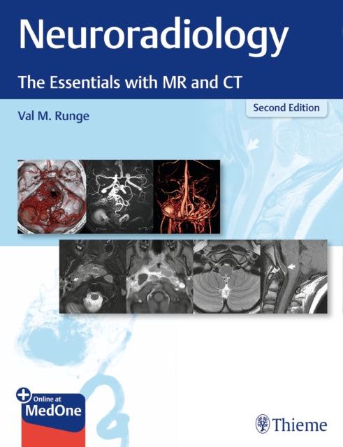 Book cover of: Neuroradiology. By: Val M. Runge